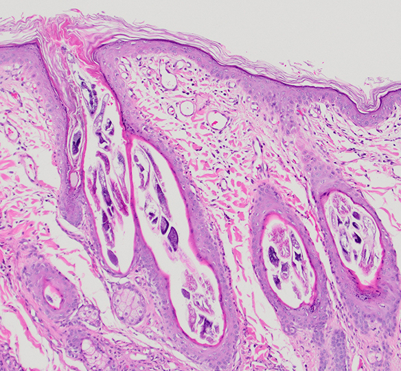 How to Prepare Veterinary Pathology Samples - Innovative Vet Path